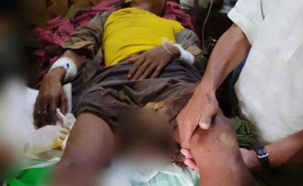 ဓာတ်ပုံ-APM