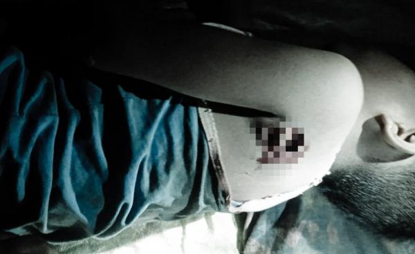 ကျောကုန်းတွင် လက်နက်ကြီးကျည်စထိမှန်၍ သေဆုံးခဲ့ရသည့် နဂရာကျေးရွာမှကလေးကိုတွေ့ရစဉ်။