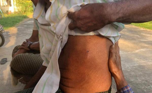 လက်နက်ကြီးကျည်စ ထိမှန်ခဲ့သည့် အမျိုးသားတစ်ဦး - ခေါဇာမြို့