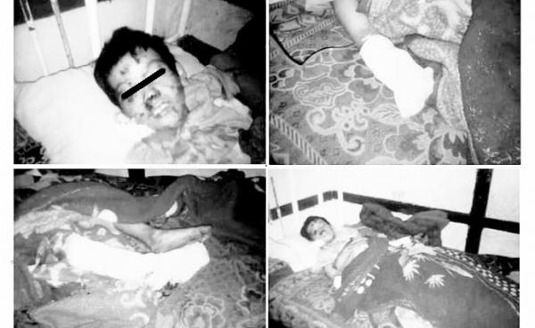 အောင်ပန်းဆေးရုံရောက်ဒဏ်ရာပြင်းထန်သည့် ကျေးသီး ငူးလိမ်ရွာမှ အသက် ၁၀ နှစ်အရွယ် စိုင်းလှိုင်းနွံ (photo/SNLD Kesi)