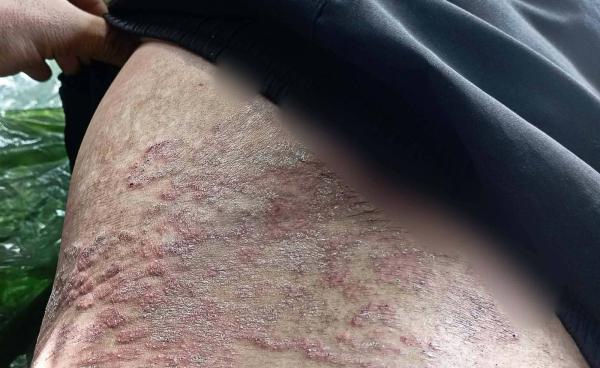 ဓါတ်ပုံ - Mg Bo (Facebook)