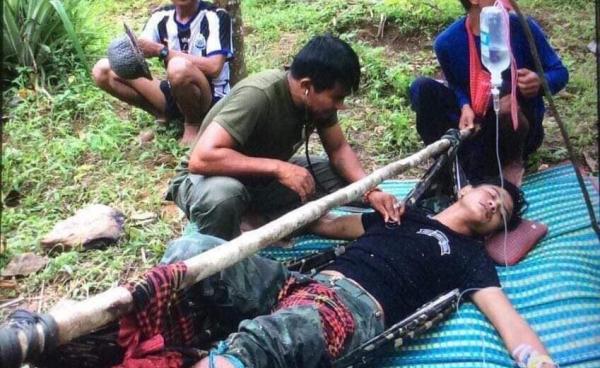 NMSP soldier was injured by the landmine on October 15 (Photo – Facebook)