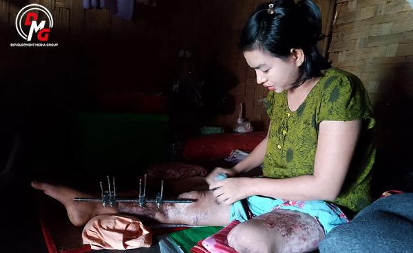 မြေမြှုပ်မိုင်းကြောင့် ခြေတစ်ဖက်ဆုံးရှုံးခဲ့ရသည့် ပလက်ဝမြို့နယ်၊ နှမဒါကျေးရွာမှ မခိုင်ခိုင်မာကို ပြီးခဲ့သည့် နိုဝင်ဘာလအတွင်းက တွေ့ရစဉ်။