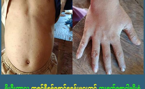 ဓါတ်ပုံ - NMG, Clean Yangon