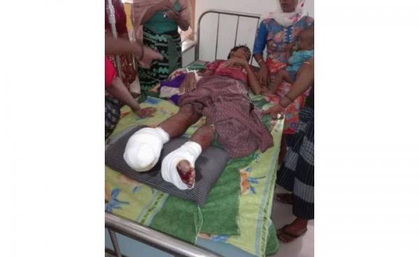 မြောက်ဦးမြို့နယ်၊ ပေါင်းတုတ်ကျေးရွာအနီးတွင် မိုင်းပေါက်ကွဲမှုကြောင့် ဒဏ်ရာရရှိသွားသည့် လူငယ်တစ်ဦးအားတွေ့ရစဉ်။ ဓာတ်ပုံ- ARE