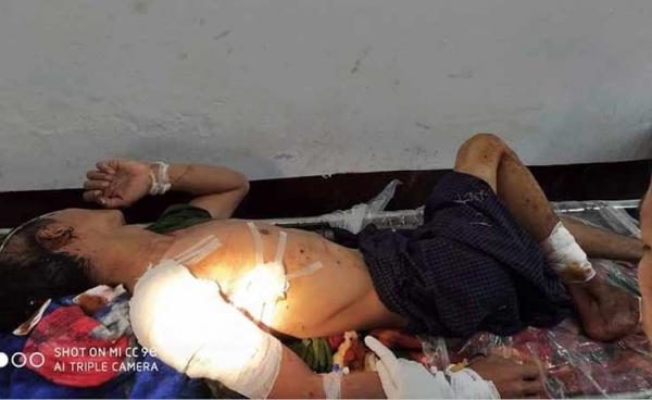 Photo - Paletwah Hospital