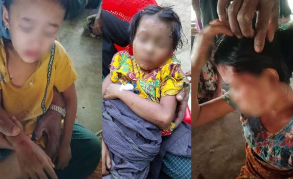 ယနေ့(နိုဝင်ဘာလ ၁၁ ရက်)တွင် လက်နက်ကြီးကျည်စထိမှန်သွားသည့် ရွှေပြည်သစ်ကျေးရွာမှ ဒေသခံများကို တွေ့ရစဉ်။