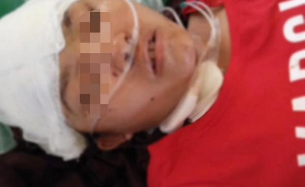 Photo form Tin Maung Thein Facebook/ ဒဏ်ရာပြင်းထန်သဖြင့် မန္တလေးဆေးရုံတွင် သေဆုံးသွားသော လွေးခမ်းယဉ်