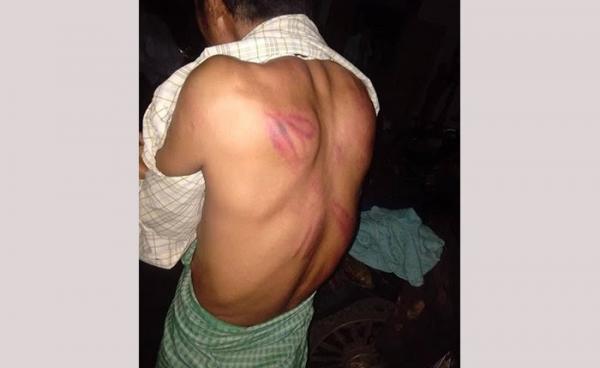 Photo by Namkham’s civil| Nyi Maung San the victim