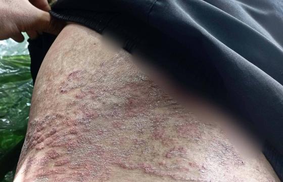 ဓါတ်ပုံ - Mg Bo (Facebook)