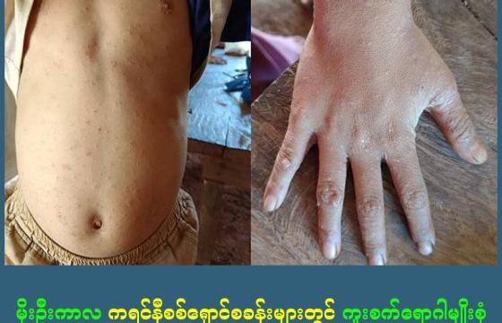 ဓါတ်ပုံ - NMG, Clean Yangon